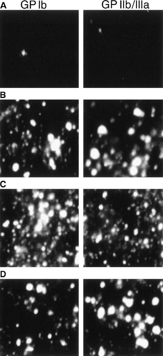 Fig. 7. Confocal microscopy images of isolated microparticles from platelets activated with HIT sera, thrombin, and calcium ionophore. / Microparticles were identified using platelet-specific primary antibody (mAb anti-GPIb and anti-GPIIb/IIIa) and a fluorescent secondary antibody (TR-conjugated goat antimouse). (A-D) Isolated microparticles following centrifugation of the platelet reaction over a sucrose layer. Very few microparticles were isolated from control reactions, in which platelets were incubated with patient serum that tested negative for (A) heparin-induced thrombocytopenia or heparin alone (data not shown). Microparticles isolated from platelets incubated with (B) heparin-induced thrombocytopenia serum, (C) thrombin, and (D) ionophore were less than 0.1 to 1.0 μm in diameter and demonstrated a similar degree of size heterogenosity and staining intensity as microparticles in unfractionated platelet reactions (not shown). The results of a representative experiment are shown.