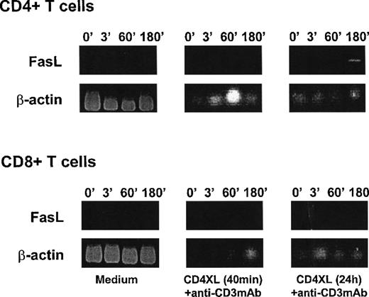 Fig. 3. CD3 stimulation induces CD95L mRNA in CD4 T cells after priming with CD4XL. / Purified CD4 T cells (top) or CD8 T cells (bottom) were either untreated (medium: left panels) or CD4 cross-linked for 40 minutes (middle panel) or for 24 hours (right panel) and then stimulated with anti-CD3 mAb. Cells were harvested at the indicated times (in minutes) after addition of anti-CD3 mAb and examined for CD95L mRNA by RT-PCR. Figures show agarose gel electrophoresis stained with ethidium bromide for amplified fragments for CD95L and β-actin. Data represent 1 of 2 experiments.