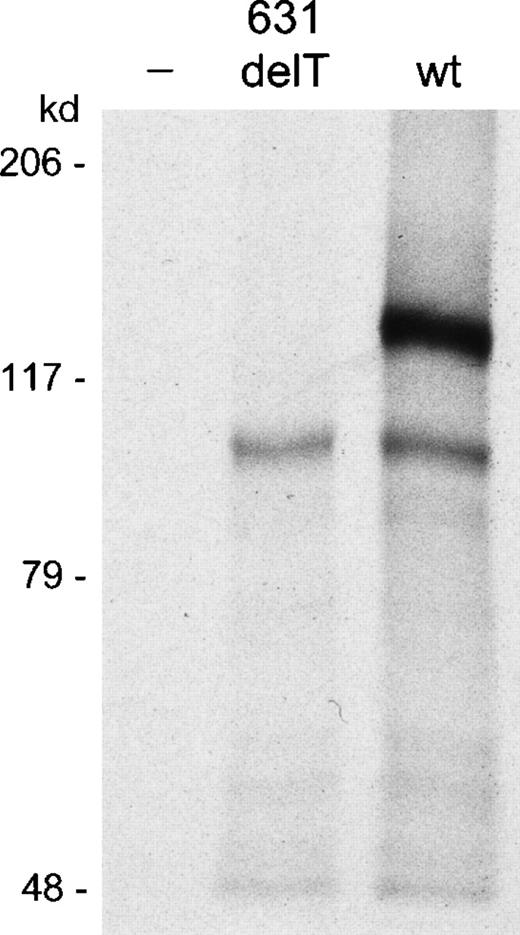Fig. 3. In vitro transcription and translation assay. / The 631delT RAG1 gene and the wt RAG1 gene were both cloned in a pGEM-T easy expression vector using the T7 promotor. Transcription and translation of the 631delT RAG1 gene showed absence of the 119-kd wt protein band, which was present in the lane of the wt RAG1 gene. The 631delT showed only the smaller 100-kd N-terminal truncated protein band, which was also present in the wtRAG1 gene lane.