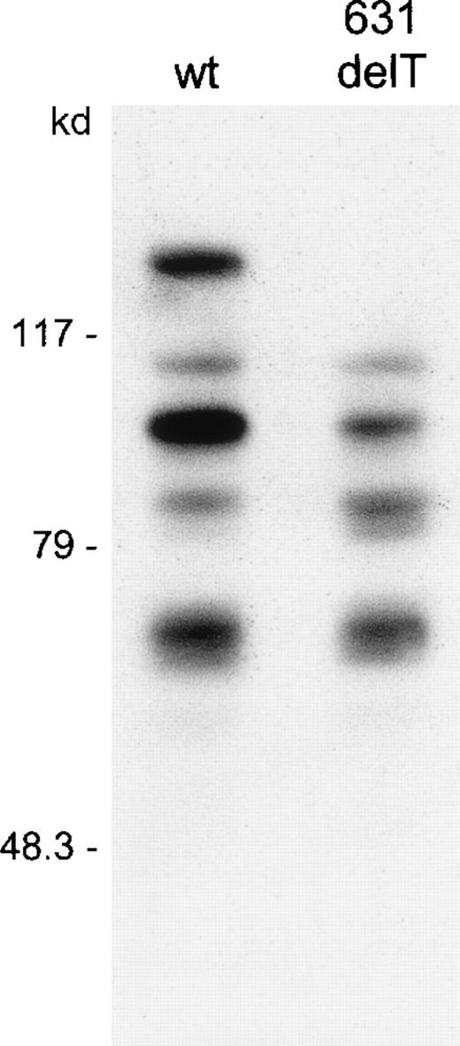 Fig. 4. Western blotting after transfection of COS cells with wt RAG1 and 631delT RAG1 constructs. / RAG1 proteins with c-myc tag were detected using a c-mycantibody and were visualized by enhanced chemiluminescence. The upper band in the wt lane represents the 119-kd wt RAG1 protein, which is absent in the 631delT RAG1 lane. Both the wt RAG1 and the 631delT RAG1 gene express the 100-kd N-terminal truncated protein. In both lanes additional protein products are seen, representing degradation products of the RAG1 protein, which is in line with the short half-life of this protein.