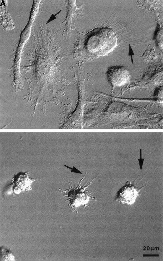 Fig. 1. Type-I IFNs alter the morphology of DC derived from CD14+ precursors. / Mature DC were produced in vitro by culture with GM-CSF, IL-4, and TNF-α, as described in Materials and methods. IFN-β was added to the wells at a final concentration of 1 ng/mL on days 1 and 4 of culture. (A) Photographs of DC were taken on day 10 of culture, as described in Materials and methods: control DC (A, top), IFN-β–cultured DC (A, bottom). Arrows indicate dendritic processes within veils, and the 20-μm reference bar is identical for both panels. (B) On day 10 of culture, cells were harvested and subjected to flow cytometric analysis to evaluate light-scattering properties by forward (x-axis) and side (y-axis) scatter. Nonviable cells were eliminated from analysis using propidium iodide. Results are representative of 5 independent experiments. IFN-β was added at days 1 and 4 of culture at the indicated concentrations.