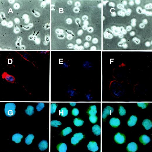 Fig. 2. Phase-contrast microscopy and immunofluorescence staining of BALL cells that express either N17Rac1 or N17CDC42. / Cells were cultured on the culture slide coated with either MOPC195 or B6H12 (10 μg/mL) for 5 hours. The morphology of the BALL cells was photographed under phase-contrast microscopy. For immunofluorescence staining, the cells were fixed and stained with either anti-mycmAb 9E10 or phalloidin, as described in “Materials and methods.” (A-C) Phase-contrast micrograph in the incubation on immobilized B6H12. (D-F) Immunofluorescence staining with phalloidin on immobilized B6H12. (G-I) Immunofluorescence staining with 9E10 on B6H12. (A, D, G) Vector. (B, E, H) N17Rac1N6. (C, F, I) N17CDC42N102. Initial magnifications, × 400 in A-C and × 1000 in D-I.