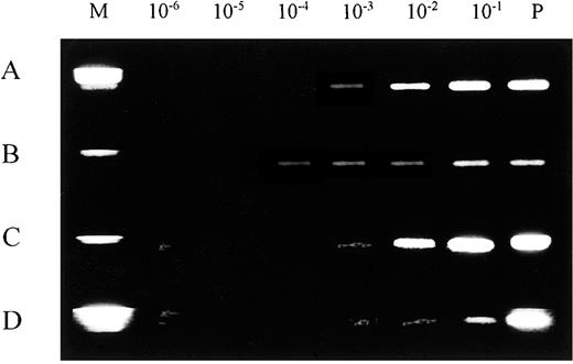 Fig. 1. Limiting dilution experiments for rearranged IGH and TCRD. / Rearranged IGH and TCRD amplified segments are shown by ethidium bromide gel staining. (A) IGH, leukemic cell DNA. (B) TCRD, leukemic cell DNA. (C) IGH, Guthrie card DNA. (D) TCRD, Guthrie card DNA. Standard limiting dilution (10−1 through 10−6) was prepared with positive control cells. The limit for detecting the IGH rearrangement was approximately 10−3 compared with 10−4 for TCRD in leukemic cells DNA. M indicates DNA size marker; P, amplified product from 100 ng positive control DNA; and N, amplified product from negative control DNA.