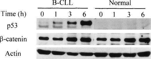 Fig. 4. p53 accumulation after lactacystin treatment in B-CLL but not in normal lymphocytes. / Western blot analyses of β-catenin and nuclear wild-type p53 at different times after lactacystin (2.5 μmol/L) treatment of B-CLL or PBL compared with untreated cells (time 0). Note that an equal amount of protein (derived from 1.5 × 106 cells) was deposited in each lane and visualized by actin protein levels. The results represent analyses of cells from 10 different patients and 10 different normal donors.