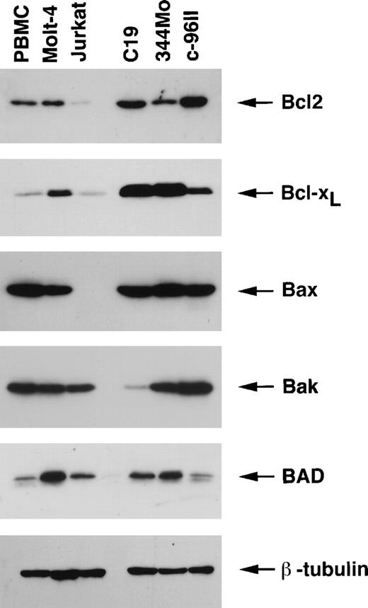 Fig. 2. Expression of the Bcl2 family proteins in HTLV-II–transformed and HTLV-II–immortalized cell lines. / Total proteins (50 μg) were resolved on 12.5% SDS-PAGE and transferred onto PVDF membranes and probed with specific antibodies for Bcl2, Bcl-XL, Bax, Bak, and BAD. Comparable protein loading was verified using an antibody specific for the housekeeping gene product β-tubulin. Results are representative of 2 independent experiments using uninfected PBMCs from 2 separate donors.