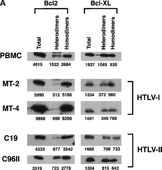Fig. 4. Increased antiapoptotic homodimers to heterodimers in HTLV-I–transformed cells. / (A) Protein extracts from uninfected PBMCs, HTLV-I cell lines (MT-2 and MT-4), and HTLV-II cell lines (C19 and C96II) were immunoprecipitated with mixed antibodies against Bax, Bak, and BAD, and the immunocomplexes were probed with either Bcl2 or Bcl-XL(heterodimers). Depletion of Bax, BAD, and Bak was confirmed by Western blot, and the proteins in the depleted fraction were immunoprecipitated with antibodies directed against either Bcl2 or Bcl-XL (homodimers). The relative intensity of each band was calculated by densitometry and is presented as an arbitrary unit. (B) The ratio of heterodimers to homodimers was calculated from 2 independent immunoprecipitations.