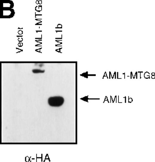 Fig. 1. Up-regulation of G-CSFR by AML1-MTG8 and down-regulation by AML1b in L-G infectants. / (A) Schematic representation of AML1b protein, AML1-MTG8 protein, and deletion mutants of AML1-MTG8 proteins, D538 and D487. Runt indicates the runt homology region; PST, proline, serine, threonine-rich region; NHR, nervy homology region; Zn, zinc finger motifs. Note that AML1-MTG8 retains the runt homology region and most of the MTG8 protein. (B) Expression of AML1b and AML1-MTG8 protein in L-G cells detected by Western blot analyses. Proteins from the L-G infectants with viruses encoding AML1b and AML1 MTG8 or with a control virus were analyzed by immunodetection using anti-HA antibody. The positions of AML1 and AML1-MTG8 are indicated by arrows. (C) Ligand binding assay for G-CSFR activity of L-G infectants. The activity was measured as described in “Materials and methods.” (D) Northern blot analyses showing the expression of G-CSFR mRNA. Total RNAs (5 μg of RNA) were prepared from L-G infectants cultured with IL-3, blotted, and hybridized with32P-labeled mouse G-CSFR cDNA and human G3PDH cDNA. (E) Northern blot analyses showing the expression of G-CSFR mRNA in deletion mutants of AML1-MTG8. Total RNAs were prepared from L-G infectants cultured with IL-3, blotted, and hybridized with32P-labeled mouse G-CSFR cDNA and human G3PDH.