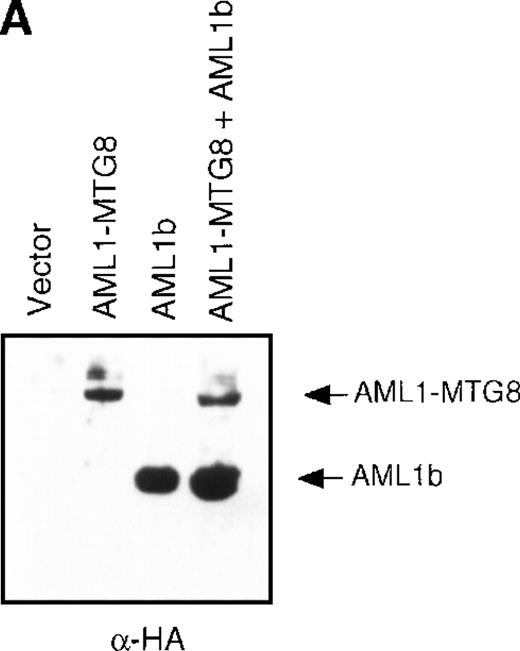 Fig. 2. Inhibition of AML1-MTG8–induced up-regulation of G-CSFR by AML1b. / (A) Expression of AML1b and AML1-MTG8 protein detected by Western blot analyses. L-G cells infected with LXSH or LXSH-AML1-MTG8 were further infected with LNSX-AML1b viruses and the protein extracts from the infectants were analyzed by immunodetection using anti-HA antibody. The positions of AML1 and AML1-MTG8 are indicated by arrows. (B) Northern blot analyses showing the expression of G-CSFR mRNA. Total RNAs (5 μg of RNA) were prepared from L-G infectants cultured with IL-3, blotted, and hybridized with 32P-labeled mouse G-CSFR cDNA, mouse MPO cDNA, and human G3PDH cDNA.