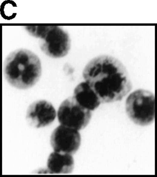 Fig. 7. Overexpression of G-CSFR stimulates cell proliferation in response to G-CSF. / (A) Growth curves of L-G cells infected with LNSX retroviruses carrying mouse G-CSFR cDNA or AML1-MTG8 cDNA in the presence of G-CSF. (B) Correlation between G-CSFR activity and the rate of proliferation in the presence of G-CSF. The 32Dcl3 transfected cells were inoculated into medium supplemented with 10 ng/ml of G-CSF at a cell density of 2 × 104 cells/mL, and cell numbers were counted with a Coulter counter after 5 days of incubation. (C) Cell morphology of G-CSFR transformed GR8 cells when cultured with G-CSF for 10 days. GR8 is a representative clone that expresses G-CSFR at a high level. Cells were stained with May-Gruenwald-Giemsa solution.