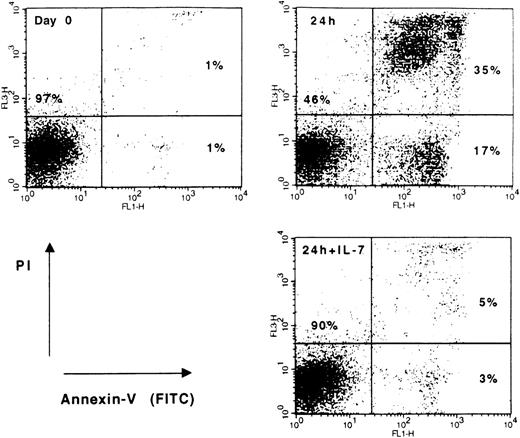 Fig. 1. Flow cytometric analysis of spontaneous apoptosis and cytokine effects in leukemic cells from a patient with cortical T-ALL. / Blast cells were either cultured in medium alone or treated with 25 ng/mL rIL-7 for 24 hours. Freshly isolated (day 0) and cultured (24 hours; 24 hours +IL-7) cells were stained with annexin V-FITC and PI to differentiate between viable (lower-left quadrant) and apoptotic (lower- and upper-right quadrants) cells. Data shown are representative of T-ALL responsive to IL-7.