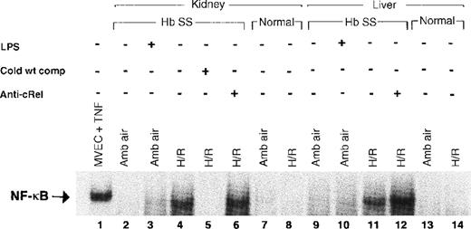 Fig. 3. Electrophoretic mobility shift assay for NF-κB. / Lane 1, positive control with TNF-treated microvascular endothelial cells. Lanes 3 and 10 show a weak NF-κB band in mice pretreated withEscherichia coli LPS and D-galactosamine, a combination that stimulates murine NF-κB activation. The sickle mouse kidney reveals a strong NF-κB band after H/R (lane 4), which is not present in the sickle mouse at ambient air (lane 2). The band on lane 4 is identified as NF-κB by the ability to competitively inhibit it with unlabeled NF-κB consensus oligonucleotide (lane 5). Sickle mouse liver at ambient air shows a faint NF-κB band (lane 9) that is much more prominent in the mouse liver after H/R (lane 11). This band is competitively inhibited by unlabeled NF-κB consensus oligonucleotide (data not shown). Antibody to the cRel subunit of NF-κB does not cause a supershift in sickle mouse liver or kidney. There is no NF-κB band demonstrable in the normal mouse liver or kidney with or without H/R. Hb SS indicates sickle mouse; LPS, Escherichia colilipopolysaccharide plus D-galactosamine; cold wt comp, unlabeled NF-κB consensus oligonucleotide probe; anti-cRel, antibody to cRel subunit of NF-κB; MVEC, microvascular endothelial cell; TNF, tumor necrosis factor; amb air, ambient air; H/R, hypoxia and reoxygenation.