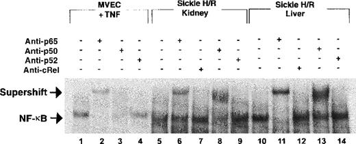 Fig. 4. Electrophoretic mobility shift assay with antibody supershift to identify the subunits of NF-κB in the kidney and liver of sickle mice exposed to H/R. Lanes 1 to 4, TNF-treated MVEC controls; lanes 5 to 9, sickle mouse kidneys after H/R; lanes 10 to 14, sickle mouse liver after H/R. The supershift assay shows the presence of the p65 (lanes 6 and 11) and p50 (lanes 8 and 13) subunits of NF-κB in the kidney and liver of the sickle mice after H/R. There is no retardation with antibodies to p52 and cRel, suggesting that these subunits are not involved in the H/R-induced activation of NF-κB. This experiment also confirms that the identified bands are indeed caused by the presence of NF-κB. MVEC indicates microvascular endothelial cells; TNF, tumor necrosis factor; H/R, hypoxia and reoxygenation; anti-p65/50/52/cRel, antibodies to these NF-κB subunits.