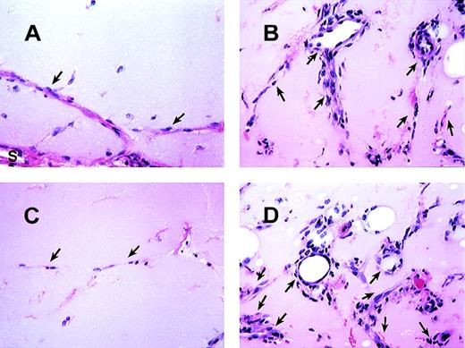 Fig. 4. MCP-1 induced angiogenesis in matrigel plugs. / The histologic appearance of matrigel plug sections after 7 days with or without MCP-1. (A) Matrigel plug section without MCP-1. (B) Matrigel plug containing 100 ng/mL of MCP-1. (C and D) The effects of Ab to MCP-1 (C) and control rabbit Ab (D) on matrigel plugs containing 100 ng/mL of MCP-1. As indicated, formation of vessels is basely observed in matrigel alone. “S” indicates stroma surrounding the plugs. Arrows point to endothelial cells forming vessels. All figures are at 340× magnification. One representative field from 2 experiments is shown.