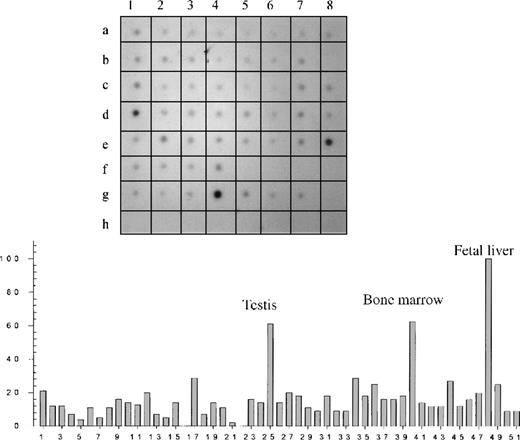 Fig. 1. Dot-blot analysis of different tissues. / (Top) An autoradiography of a dot blot containing 51 different human tissue RNAs hybridized with a Kell radioactive riboprobe. (Bottom) Relative concentration values obtained by densitometry analysis. Tissue RNAs can be identified according to their position on the blot and their number as summarized in Table 1.