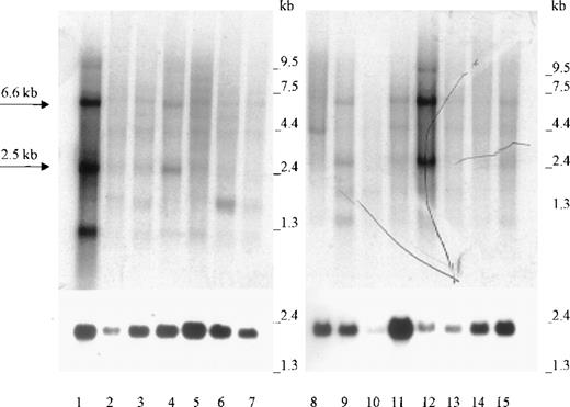Fig. 2. Northern blot analysis. / Lanes 1 to 15 contain approximately 2 μg poly A+ RNA from (in the following order): bone marrow, adrenal gland, trachea, lymph node, spinal cord, thyroid, stomach, peripheral blood leukocytes, colon, small intestine, uterus, testis, prostate, thymus, and spleen. The 2.5-kb and 6.6-kb Kell transcripts are marked by arrows. Hybridization was performed with radioactive Kell antisense RNA (upper panel) or with radioactive β-actin cDNA (lower panel).