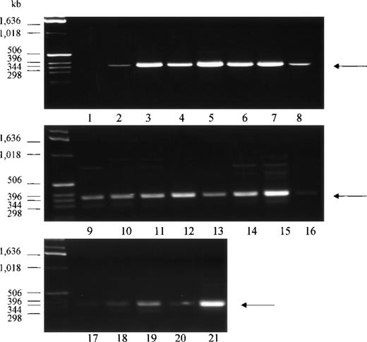 Fig. 3. PCR analysis of Kell cDNA. / Normalized first strand cDNA preparations from different human tissues as indicated below were screened by PCR. Primers were designed to amplify a 386-bp segment (arrow). (1) Control (no template cDNA), (2) peripheral blood leukocytes, (3) bone marrow, (4) lymph node, (5) fetal liver, (6) tonsils, (7) spleen, (8) thymus, (9) brain, (10) heart, (11) kidney, (12) liver, (13) lung, (14) pancreas, (15) placenta, (16) skeletal muscle, (17) colon, (18) ovary, (19) prostate, (20) small intestine, and (21) testis.