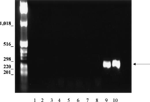 Fig. 4. PCR analysis of GPA cDNA. / Normalized first strand cDNA preparations from different human tissues as indicated below. Primers were designed to amplify a 330-bp segment (arrow). (1) Control (no template cDNA), (2) brain, (3) skeletal muscle, (4) lung, (5) liver, (6) spleen, (7) lymph node, (8) peripheral blood leukocytes, (9) bone marrow, and (10) fetal liver.