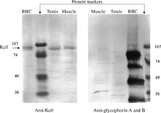 Fig. 5. Western blot analysis. / Integral membrane proteins (pH 11.5) from red blood cells, testis, or skeletal muscle were reduced, separated by SDS-PAGE, blotted, and detected with polyclonal antibody to Kell (left panel) or with a monoclonal antibody that recognizes glycophorins A and B (right panel). (Left panel) A single 93-kD band (arrow), the molecular size of Kell, was detected in red blood cells, testis, and skeletal muscle. (Right panel) Multiple bands corresponding to glycophorins A and B were detected in red blood cells but not in testis or skeletal muscle.