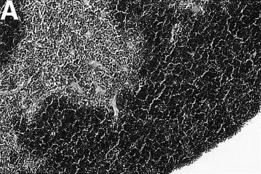 Fig. 1. Thymic disease is a consequence of acute but not chronic GVHD. / Acute GVHD was induced by the transfer of 50 × 106parental B6 splenocytes to unirradiated B6D2F1 mice (B), whereas chronic GVHD was induced by the transfer of 80 × 106 parental DBA/2 splenocytes to unirradiated B6D2F1 mice (C). Syngeneically transplanted B6D2F1 mice served as controls (A). Frozen thymic sections (5 μm) were analyzed for histopathology at 2 weeks after transplantation. Magnification ×200. (D) Thymic cellularity as a function of time (total cells per thymus × 10−6) in syngeneically transplanted mice (▵) and in mice with acute (•) and chronic (□) GVHD, respectively. The figure represents combined data (mean ± SEM) of individual mice from at least 8 separate experiments; 20 to 42 mice were analyzed for each group.
