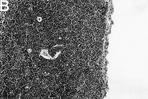 Fig. 1. Thymic disease is a consequence of acute but not chronic GVHD. / Acute GVHD was induced by the transfer of 50 × 106parental B6 splenocytes to unirradiated B6D2F1 mice (B), whereas chronic GVHD was induced by the transfer of 80 × 106 parental DBA/2 splenocytes to unirradiated B6D2F1 mice (C). Syngeneically transplanted B6D2F1 mice served as controls (A). Frozen thymic sections (5 μm) were analyzed for histopathology at 2 weeks after transplantation. Magnification ×200. (D) Thymic cellularity as a function of time (total cells per thymus × 10−6) in syngeneically transplanted mice (▵) and in mice with acute (•) and chronic (□) GVHD, respectively. The figure represents combined data (mean ± SEM) of individual mice from at least 8 separate experiments; 20 to 42 mice were analyzed for each group.