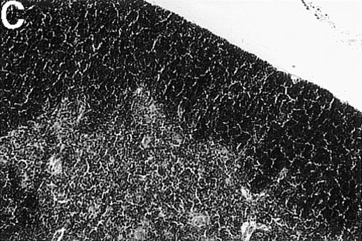 Fig. 1. Thymic disease is a consequence of acute but not chronic GVHD. / Acute GVHD was induced by the transfer of 50 × 106parental B6 splenocytes to unirradiated B6D2F1 mice (B), whereas chronic GVHD was induced by the transfer of 80 × 106 parental DBA/2 splenocytes to unirradiated B6D2F1 mice (C). Syngeneically transplanted B6D2F1 mice served as controls (A). Frozen thymic sections (5 μm) were analyzed for histopathology at 2 weeks after transplantation. Magnification ×200. (D) Thymic cellularity as a function of time (total cells per thymus × 10−6) in syngeneically transplanted mice (▵) and in mice with acute (•) and chronic (□) GVHD, respectively. The figure represents combined data (mean ± SEM) of individual mice from at least 8 separate experiments; 20 to 42 mice were analyzed for each group.