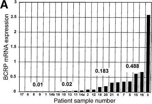 Fig. 1. BCRP and MDR1 mRNA expression in blast cells. / (A) Expression of BCRP mRNA in blast cell samples from 21 patients with acute leukemia, determined by RT-PCR, as described in “Study design.” Data are expressed relative to the expression of BCRP mRNA in MCF-7 cells, after correction for the expression of β-actin mRNA in the sample, and are arranged in the figure in the order of magnitude of BCRP expression. The numbers given in the figure refer to the median values of BCRP expression for each quartile. Patient sample number is a unique identifier for each patient in the study. (B) Expression of MDR1 mRNA in blast cell samples from 9 patients with acute leukemia, determined by RT-PCR, as described in “Study design.” Data are expressed relative to the expression of MDR1 mRNA in HL-60/Vinc cells (× 10−7), after correction for the expression of β-actin mRNA in the sample. (C) Correlation of the expression of MDR1 mRNA with the expression of BCRP mRNA in blast cells from 9 acute leukemia patients. BCRP mRNA expression is reported relative to MCF-7 cells. MDR1 mRNA expression is reported relative to HL-60/Vinc cells (× 10−7).