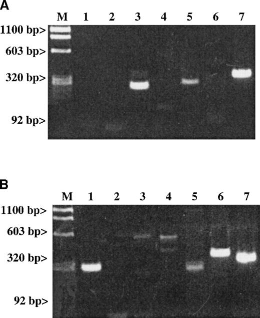 Fig. 3. Studies examining whether the messages of either SDF-1 or MDC are detectable in platelet total RNA. / Results are given for (A) RT-PCR of human platelets and (B) RT-PCR of stromal cells. The expected size for each band is indicated. Lane 1: An SDF-1 message (281 bp) is present in stromal cells but not in platelets. Lane 2: An MDC message (270 bp) is also absent in platelets. Lanes 3-5 represent the following messages: Lane 3: A RANTES message (238 bp); Lane 4: An IL-8 message (536 bp); and Lane 5: An MIP-1α message (254 bp). Lane 6: The LFA-1 message (353 bp) is a white cell–specific message showing that the preparation is clean of contaminating white cell messages at the level of RT-PCR examined. Line 7: The ubiquitous message from β-actin (309 bp) was used as a general positive control for the RT-PCR studies.