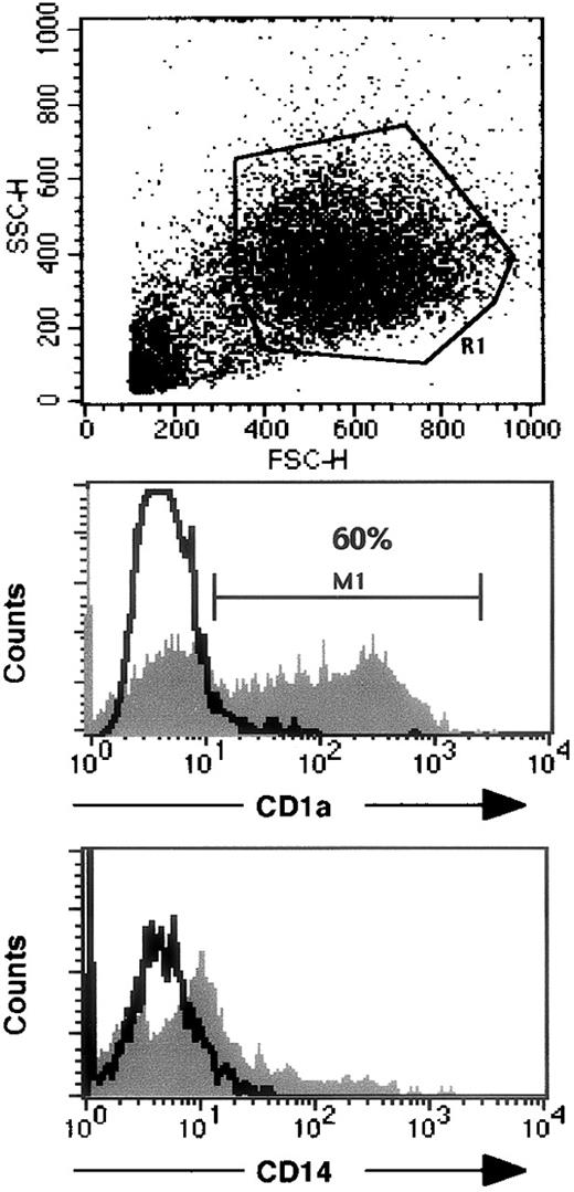 Fig. 4. Flow cytometry analysis of monocyte-derived DC from a patient with reticular dysgenesis and chimeric hematologic reconstitution. / The upper panel indicates FSC and SSC characteristics of DC cultured as described in the “Patients and methods” section. Expression of CD1a and CD14 on gated viable cells (R1) are represented on the middle and lower panels, respectively. Open histograms represent isotypic controls, and filled histograms represent specific staining. 104 events were analyzed with a FACScalibur using CellQuest software.
