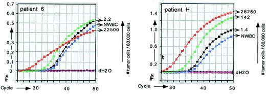 Fig. 2. Real-time PCR quantitation of tumor cells from patient 6 and patient H. / Tumor cells were quantitated with IgH ASO–PCR using consensus sense primers (Table 1) and tumor-specific antisense primers (for patient 6) or vice versa (for patient H). Both strategies resulted in false positivity in control NWBC populations for these patients.