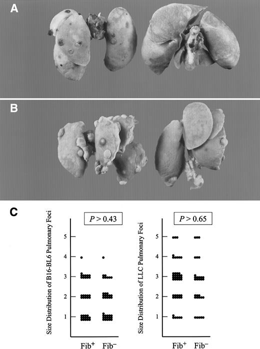 Fig. 2. Fibrinogen deficiency diminished the metastatic potential of circulating tumor cells but not the growth of metastatic foci. / Representative examples of metastatic pulmonary foci produced 21 days after intravenous injection of 1.7 × 104 B16-BL6 cells (A) and 1 × 105 LLC cells (B) into the lateral tail vein. Lungs from fibrinogen-deficient mice are pictured on the right and controls on the left. (C) Scatter plot of the size distribution of metastatic foci with transplanted B16-BL6 (left) and LLC (right) in fibrinogen-deficient (Fib−) and control (Fib+) mice. See text for definitions of arbitrary units used for size distribution. (P values were generated using the Studentt test.)