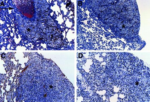 Fig. 3. Comparative microscopic analysis of metastatic foci in fibrinogen-deficient and control mice. / Representative examples show lung metastases (∗) of B16-BL6 melanoma (A and B) and LLC (C and D) in control mice (A and C) and Fib− mice (B and D). Fibrin(ogen) deposition (appearing as red reaction product in panels A and B and brown staining in panels C and D) is apparent in the lung tissue surrounding the metastatic nodule of the control mice but not in the Fib− mice. The metastases from both genotypes were often pleural based and associated with blood vessels (arrow). Note the dark material in panels A and B is melanin produced by the B16-BL6 cells.