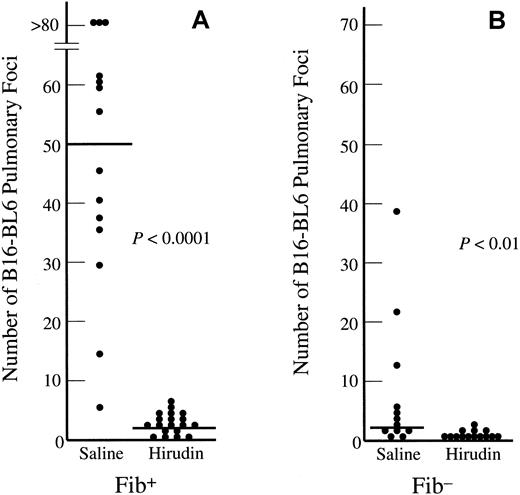 Fig. 5. Thrombin promotes the metastasis of circulating tumor cells by at least one fibrinogen-independent mechanism. / Fibrinogen-sufficient mice (A) and fibrinogen-deficient mice (B) were pretreated with 10 mg/kg hirudin or saline 20 minutes before injection of 7 × 104 B16-BL6 melanoma cells into the lateral tail vein. The mice were killed 21 days later and the surface pulmonary metastases quantitated. The data presented are the number of surface pulmonary metastases observed in individual mice. The horizontal bars represent the median value for each group. The median value for the hirudin-treated Fib− mice was 0 (B). The Pvalues were determined by the Mann-Whitney U test, 2 tailed.