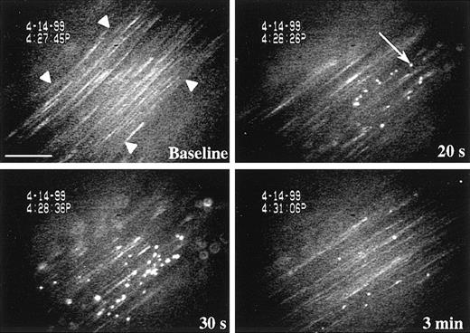 Fig. 1. Resting platelets adhere on A23187-activated mesenteric venules. / Calcein AM-labeled platelets were visualized in mesenteric venules using a fluorescent microscope. Fluorescent resting WT platelets were transfused into WT recipient mice and began to adhere to the endothelium 15 seconds after topical superfusion of the calcium ionophore A23187. The adhesion process reached a maximum between 30 seconds and 1 minute and progressively decreased with time. Platelet aggregation was not observed. Arrowheads indicate the edge of the mesenteric venule. Arrow points to a fluorescent platelet adhering to the vessel wall. Bar, 75 μm.