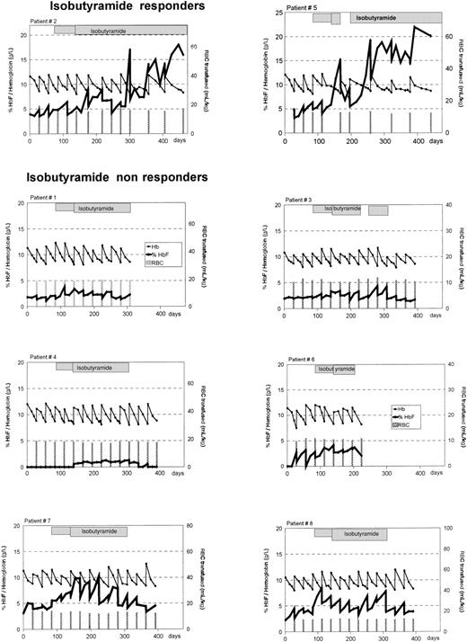 Fig. 1. Alteration in percentage of HbF and total Hb in 8 patients with homozygous β-thalassemia treated with oral IBT. / Percentage of HbF, —; total Hb, —. Bars indicate the times of blood transfusions and the volume administered. The hatched boxes indicate administration of IBT. After 8 weeks of treatment, the dosage of IBT was increased from 250 mg/kg per day to 350 mg/kg per day in each patient. Treatment was interrupted in patient no. 5 from days 172 to 200 because of septicemia and in patient no. 3 from days 224 to 252 because of peripheral neuropathy.