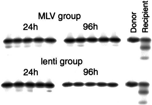 Fig. 4. Cellulose acetate hemoglobin electrophoresis of peripheral blood collected from the recipients 5 to 6 weeks after transplant, showing repopulation with donor cells. / The MLV group represents animals transplanted with cells co-transduced with eco-MLV-LacZ and M-GFP, the lenti group represents animals transplanted with cells co-transduced with eco-MLV-LacZ and L-GFP. Twenty-four hours and 96 hours represent the 2 different transduction protocols. The two left lanes represent controls: donor C57BL/6J (homozygous Hbbs/Hbbs “single” hemoglobin) and untransplanted W/Wv(heterozygous Hbbs/Hbbd “single/diffuse” hemoglobin).