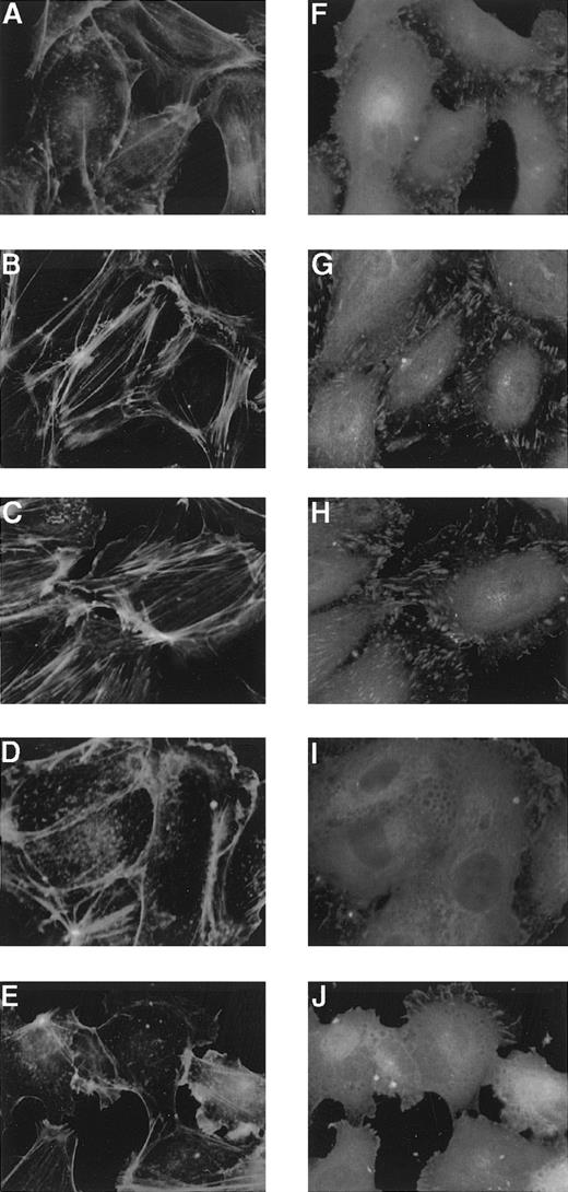 Fig. 9. Effects of Sph-1-P or LPA on HUVEC cytoskeletal reorganization. / HUVECs were stimulated without (A and F) or with 100 nmol/L (B and G) or 1 μmol/L (C and H) Sph-1-P or 100 nmol/L (D and I) or 1 μmol/L (E and J) LPA for 30 minutes, fixed, and then incubated with anti-paxillin for detection of focal adhesions (F to J) and with FITC-conjugated phalloidin for actin stress-fiber staining (A to E).