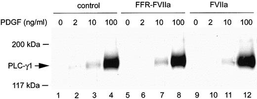 Fig. 7. Tyrosine phosphorylation of PLC-γ1 in response to PDGF-BB alone (control), FVIIa, or FFR-FVIIa in combination with PDGF-BB. / Cells were incubated with 100 nmol/L FVIIa or FFR-FVIIa for 1 hour and then with or without PDGF-BB at indicated concentrations. Cell were lysed, and tyrosine phosphorylation of PLC-γ1 was detected as described in “Materials and methods.”