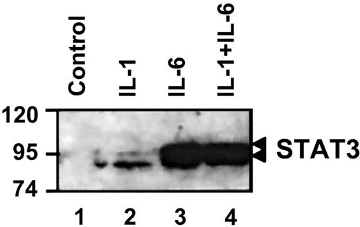 Fig. 3. IL-1β does not affect IL-6-mediated STAT3 activation. / Nuclear extracts were prepared from rat primary hepatocytes following exposure to the indicated cytokines. Western blot analysis was performed as described in “Materials and methods.” The migration position of STAT3 is indicated on the right side.