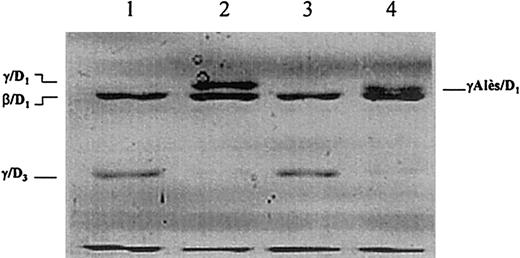 Fig. 4. Plasmin degradation of fibrinogen analyzed by SDS-PAGE according to Laemmli after reduction with 2-mercaptoethanol. / Lanes 1 and 2, plasmin digest of normal fibrinogen in the presence of 10 mmol/L EDTA and 5 mmol/L CaCl2, respectively. Lanes 3 and 4, plasmin digest of fibrinogen Alès in the presence of 10 mmol/L EDTA and 5 mmol/L CaCl2, respectively.