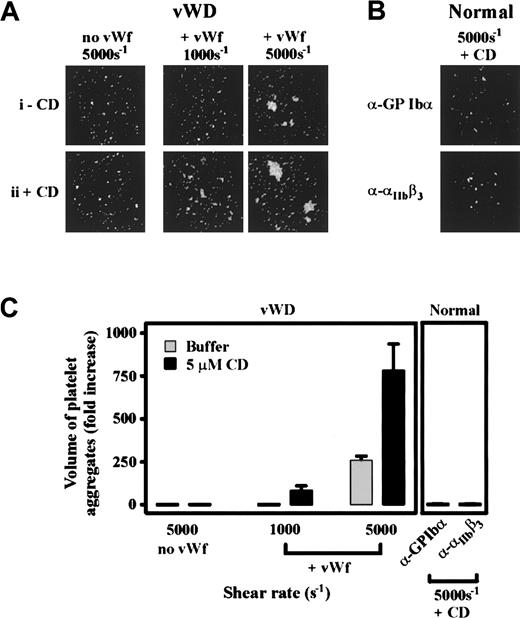 Fig. 7. An essential role for vWf, GPIb/V/IX, and integrin αIIbβ3 in mediating shear-induced platelet aggregation in the presence or absence of cytochalasin D. / (A) Platelet-rich plasma (PRP) from an individual with type III vWD was incubated with either vehicle alone (−CD, i) or 5 μmol/L CD (+CD, ii) prior to exposing platelets to a shear rate of 5000 s−1 (top panel). Alternatively, purified HvWf (20 μg/mL) was added to vWD PRP (+ vWf) prior to their exposure to the indicated shear rates. The size of platelet aggregates formed under the various experimental conditions was determined as described in Figure6. (B) Washed platelets from a normal donor were incubated with an anti-GPIb (ALMA12) or anti-β3 integrin mAb (c7E3 Fab) for 10 minutes in the presence of 5 μmol/L CD (+ CD) prior to the exposure of platelets to shear (5000 s−1). Platelets were then imaged as described in Figure 6. (C) Platelet aggregates from 8 random fields (10 × objective) were subjected to volumetric analysis, and the extent of aggregation was expressed as the fold increase in the volume of aggregates over that detected for Me2SO-treated control platelets. Results for vWD platelets are from a single vWD patient and results for normal platelets are the mean ± SE from 5 experiments. ░, buffer; ▪, 5 μmol/L.