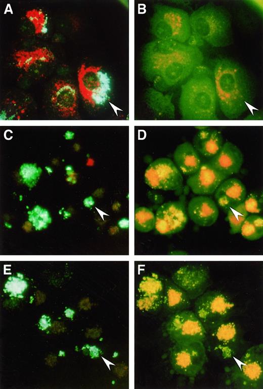 Fig. 1. Uptake of HPTS-SL and acridine orange. / by human Mφ (Α, Β), mature DC (C, D), and immature DC (E, F). Cells were incubated with HPTS-SL for 24 hours, and acridine orange was added for the last 30 minutes of culture. Cells were washed and mounted on a glass slide, and photographs were taken under a fluorescence microscope at an excitation of 350 nm to 410 nm (left) and 450 nm to 490 nm (right), respectively (magnification, 400×). Arrowheads highlight HPTS-SL in each panel; note that in Mφ most of the HPTS-SL are colocalized with acridine orange and not visible at 450 nm to 490 nm, whereas SL in DC are separated from acridine orange and visible at both wavelengths.