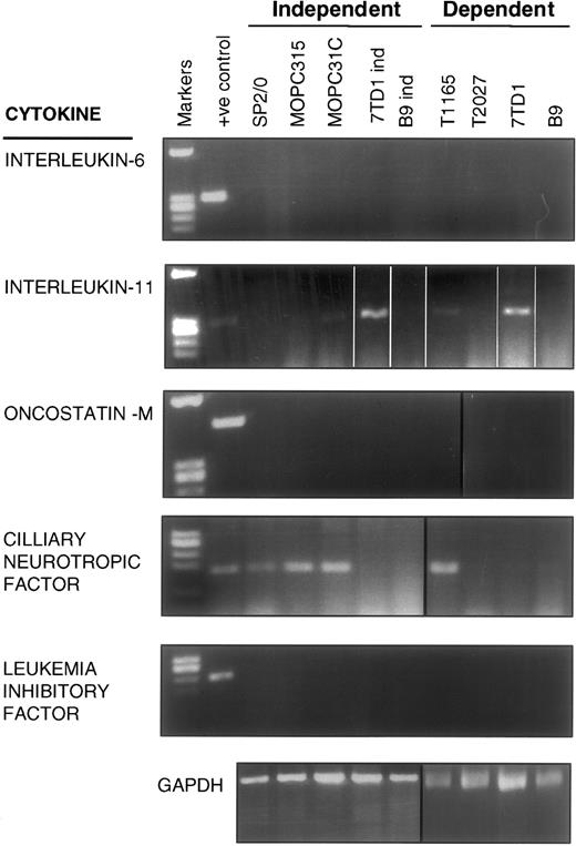 Fig. 5. RT-PCR analysis for mRNA expression of gp130-sharing cytokines in IL-6–dependent and –independent cells. / Messenger RNA was isolated from the indicated cell lines, reverse transcribed, and added to PCR reactions containing primers specific for IL-6, IL-11, OSM, CNTF, LIF, or GAPDH.