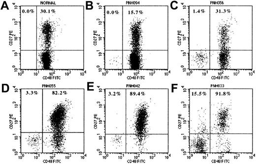 Fig. 2. Expression of CD27 by normal and PNH B cells. / Flow cytometry dot-plots show CD27 expression by normal B cells (A) and by normal (CD48+) and PNH (CD48−) components of CD19+ B cells in 5 patients with PNH (B-F). B cells were identified by CD19+SSClow characteristics. The percentage values represent the proportions of PNH and normal B cells expressing CD27. Plot A is from a normal healthy adult donor and shows no GPI− B cells and 30.1% CD27+ (memory) B cells. Plots B, C, and D are from 3 patients with PNH, with GPI− B cell clones of 0.19%, 9.64%, and 3.65% and granulocyte PNH clones of 0.9%, 31.3%, and 80.2%, respectively. These show that GPI− B cells are detectable in most patients with PNH regardless of the size of the granulocyte clone and that they have a predominantly naive (CD27−) phenotype. Plots D, E, and F are from patients with large PNH granulocyte clones (ie, predominantly GPI− hematopoiesis) and show that the residual normal B cells are predominantly CD27+ (memory phenotype). Plot F shows CD27 expression for the normal and PNH fractions of B cells from patient PNH033 who developed hemolytic PNH over 16 years ago. The residual normal B cells are almost all CD27+ and furthermore a significant proportion of the PNH B cells (15.5%) have also become CD27+, reflecting the long duration of disease in this patient.