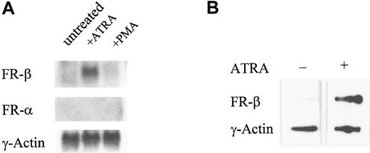 Fig. 3. Effect of ATRA on the expression of the FR-β transcript. / (A) KG-1 cells were treated with ATRA (1 μmol/L), PMA (0.05 μmol/L), or the vehicle alone for 5 days. The total RNA was purified and probed on a Northern blot with cDNA for FR-β, FR-α, or γ-actin. (B) KG-1 cells were treated with ATRA (1 μmol/L) for 6 hours. Nuclei were isolated and nuclear run-on reactions carried out as described in “Materials and methods.” Labeled RNA isolated from each reaction was used to probe immobilized cDNA for FR-β or γ-actin as described in “Materials and methods.”