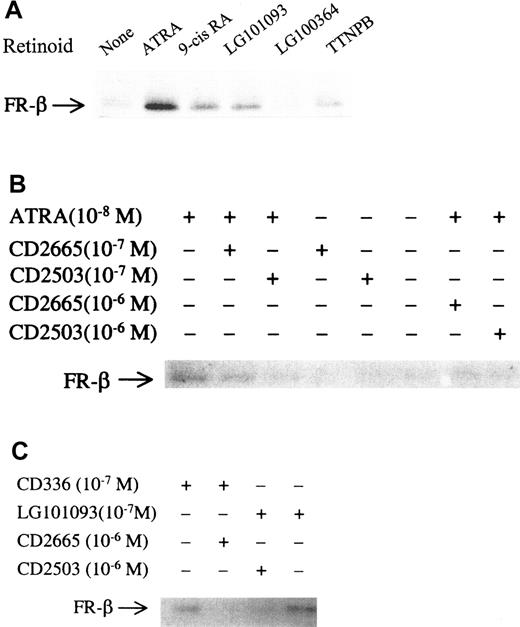 Fig. 4. Effects of various retinoid compounds on FR-β expression in KG-1 cells. / (A) KG-1 cells were treated with ATRA, 9-cis-RA, LG101093, LG100364, or TTNPB at a concentration of 1 μmol/L or with the vehicle alone for 5 days. Lysates from 1 × 106 cells from each sample were probed on Western blots with rabbit anti–FR-β antibody and AP-conjugated secondary antibody. (B) KG-1 cells were treated with different concentrations (10−7 or 10−6 mol/L) of CD2665 and CD2503, either alone or in combination with ATRA (1 × 108 mol/L), for 5 days. The cell lysates from each sample were subjected to Western blot analysis as in panel A. (C) KG-1 cells were treated with CD336 or LG101093 at a concentration of 10−7 mol/L, either alone or in combination with CD2665 or CD2503 (10−6 mol/L). The cell lysates were analyzed as in panel A. Panels A-C show representative Western blots from at least 3 experiments.