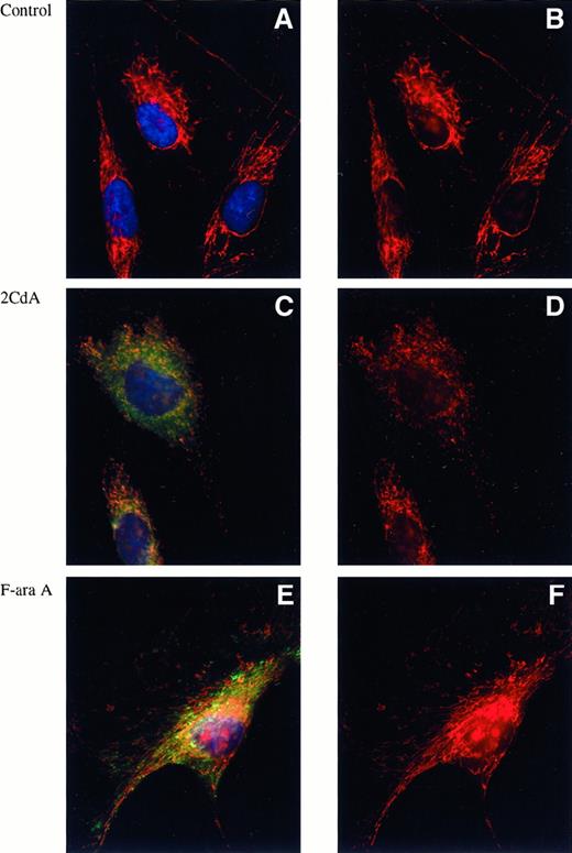 Fig. 5. Nucleotide microinjection experiments. / Human HS-68 fibroblasts were grown on coverslips. Nucleotide triphosphates were microinjected at an estimated final concentration of 500 μmo/L. To identify the microinjected cells, fluorescein isothiocyanate-labeled dextran was co-injected with the nucleotides; therefore, the microinjected cells appear in green (C, E). Cells were incubated with 150 nmol/L MT orange (red stain) for 30 minutes to stain for mitochondria membranes, and fixed in 4% paraformaldehyde, and DNA was dyed with DAPI stain (blue, A, C, E). Left panels represent composite pictures that include DNA (blue), mitochondria (red), and dextran (green for microinjected cells). Right panels (B, D, F) represent the stained mitochondria alone. Cells treated with 2CdATP show a rearrangement of the mitochondria. Cells treated with the same concentration of F-AraATP do not display the same morphologic changes. Images were obtained with a Zeiss Axioscope microscope, equipped with CCD camera, using a 40 × 1.3-na oil objective.