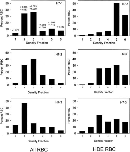Fig. 1. Sickle cell density distributions before and after isolation of dense cells. / The 3 panels on the left represent the red cell density distributions for 3 patients (H7-1, H7-2, and H7-3) prior to isolation of dense cells. On the right are shown the corresponding density distributions of the biotin-labeled HDE cells at the time of re-infusion. The density range for each fraction is shown in the upper left panel.