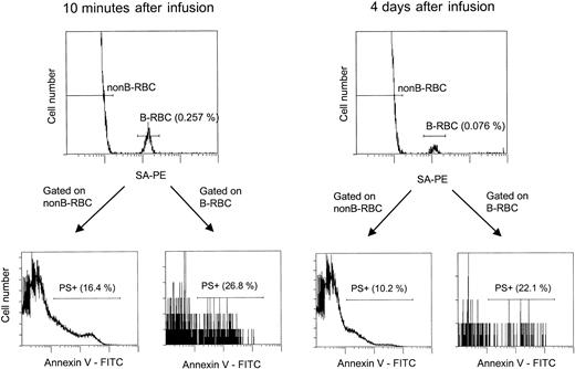 Fig. 7. The flow cytometric assay for unlabeled and biotin-labeled PS+ cells. / This analysis is similar to that shown in Figure 4, except that after incubation with SA-PE, the cells were incubated with Annexin V-FITC as described in “Materials and methods.” For patient H7-1, 2 time points are shown: 10 minutes and 4 days after infusion, with the labeled HDE cells consistently having a higher percentage of PS+ cells.