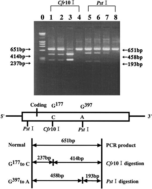 Fig. 2. ALAD genotype analysis. / ALAD genotype analysis in the family was carried out byCfr10I and PstI RFLP for the G177 to C transition and the G397 to A transition, respectively. Lanes 1 and 5, the proband; lanes 2 and 6, the sister; lanes 3 and 5, the daughter; lanes 4 and 8, healthy control.