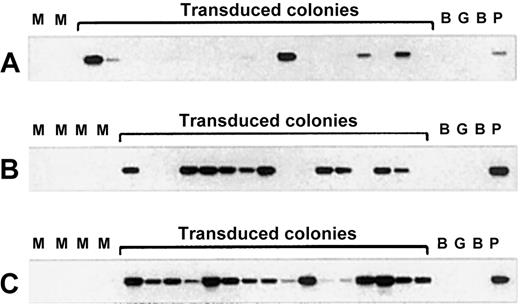 Fig. 3. Transduction efficiency of CFU-GM colonies as detected by PCR analysis of individual colonies derived from cord blood CD34+ cells transduced with the PGK-GFP vector. / (A) PCR analysis of randomly picked individual CFU-GM colonies derived from CD34+ cells directly after overnight transduction. (B) PCR analysis of CFU-GM colonies from the bone marrow of primary NOD/SCID mice engrafted with PGK-GFP transduced CD34+cells. (C) PCR analysis of CFU-GM colonies derived from secondary transplant NOD/SCID mice transduced with the same vector. M indicates mock transduced; B, blank; G, human genomic DNA; P, positive control.